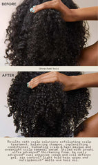 scalp solutions exfoliating scalp treatment